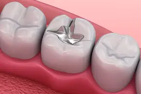 Restorative Dentistry